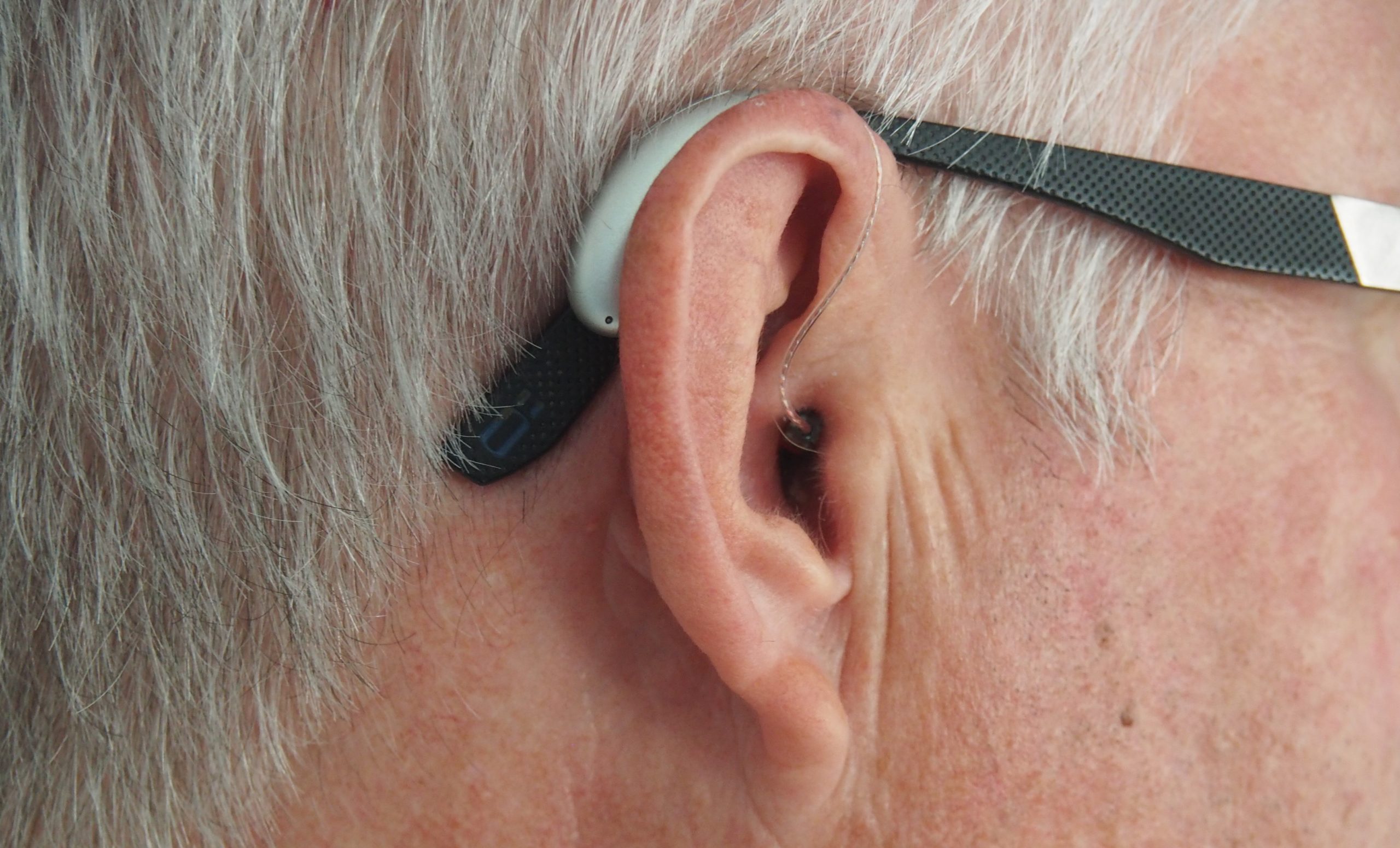 OTC Hearing Products